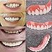 ThinkMax Silicone Smile Veneers Simulation Braces Flex Denture Paste