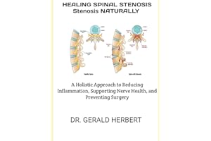HEALING SPINAL STENOSIS NATURALLY: A Holistic Approach to Reducing Inflammation, Supporting Nerve Health, and Preventing Surg