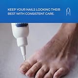 Imperial Feet Nail Revival Extra Strength 75ML Nail Care for Discolored Nails view 3