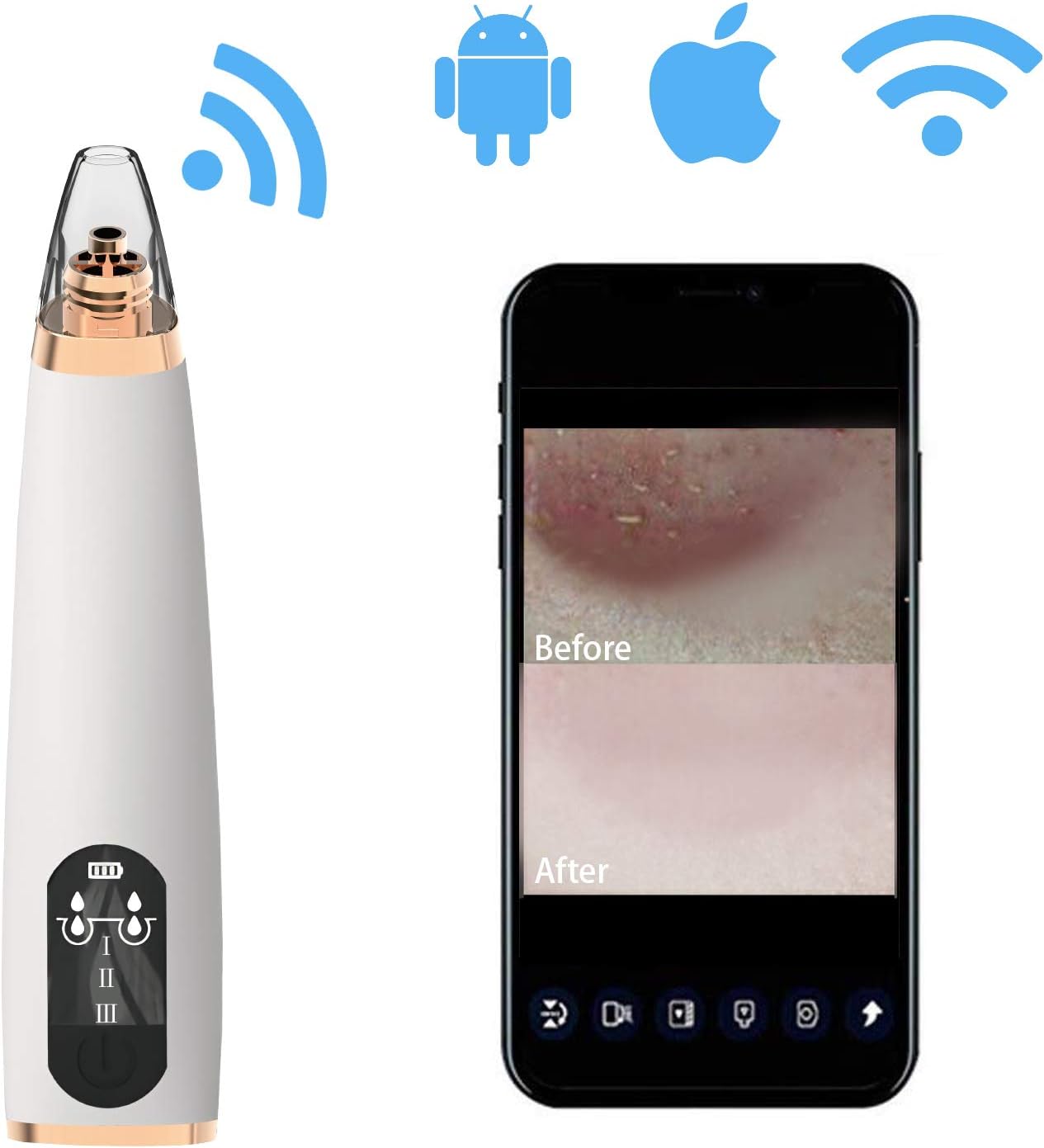 Blackhead Remover Vacuum, PELCAS Facial Acne Comedone Extractor with WiFi Visual Camera Links Phone 1080P HD Display, USB Rechargeable Blackhead Suction Tool for Facial Skin Care