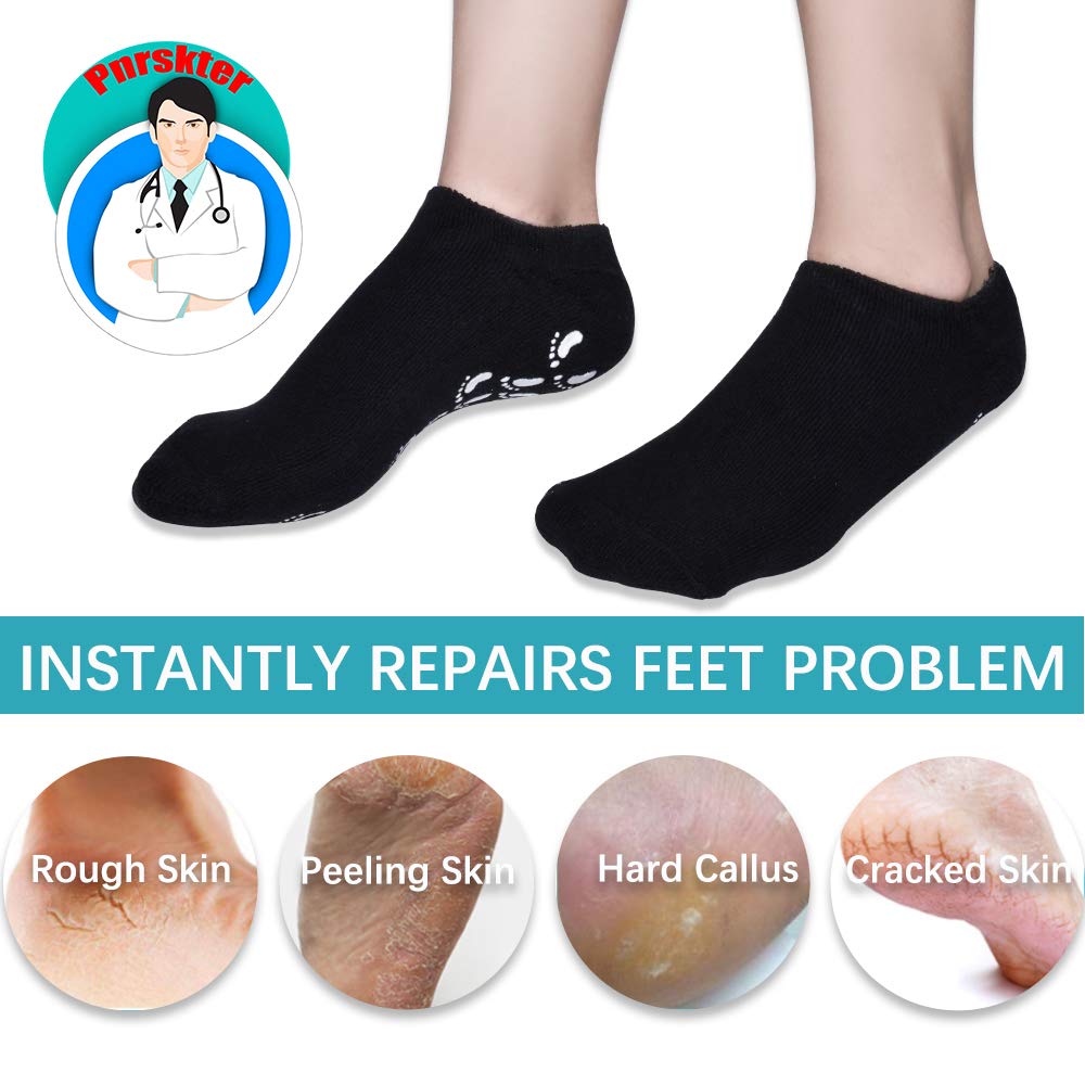 Gel Socks, Moisturizing Socks, Soft Moisturizing Gel Socks, Gel Spa Socks For Repairing and Softening Dry Cracked Feet Skins, Gel Lining Infused with Essential Oils and Vitamins (Black & Gray) … : Beauty