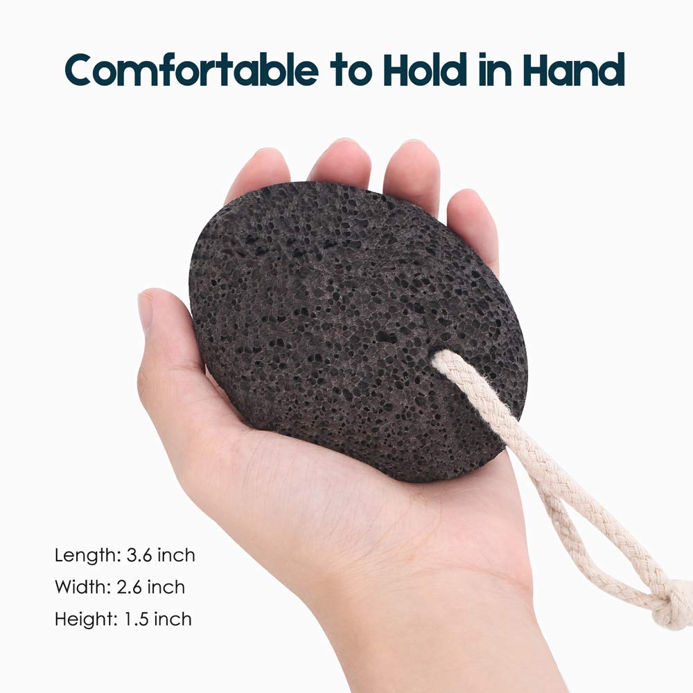 Vridale Pumice Stones for Feet Lava Pumice Stone Foot File Callus Removal Foot Scrubber for Hands Care Foot Exfoliation Dead Skin Remover with Handle: Beauty