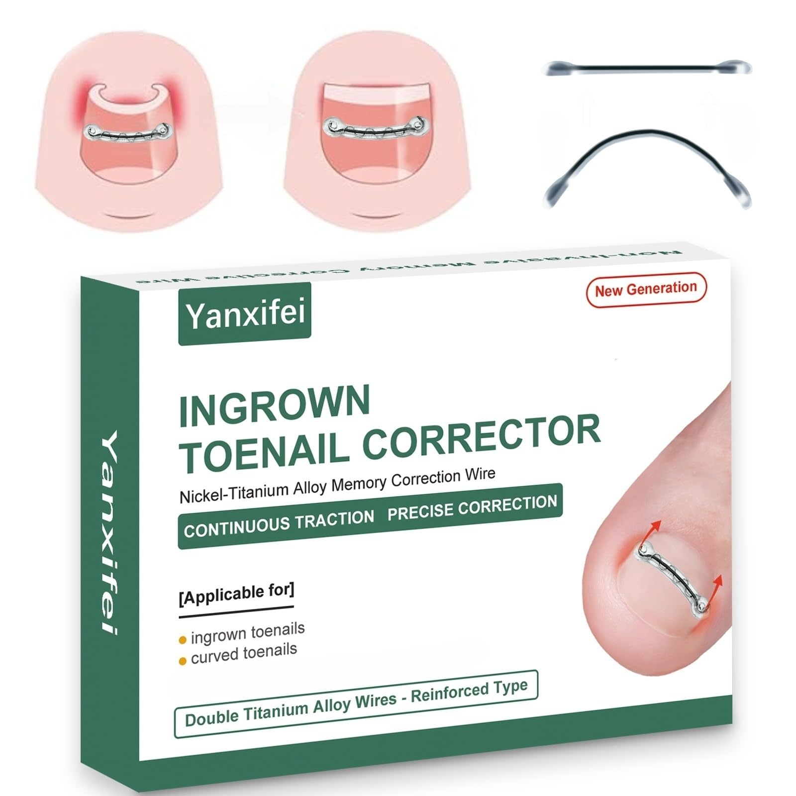 Photo 1 of Dual Nitinol Ingrown Toenail Corrector,Ingrown Toenail Treatment,Curved Toenail Straightener,Ingrown Toenail Removal Kit,Big Toe Ingrown Toenail Tool (0.55in,0.66in)