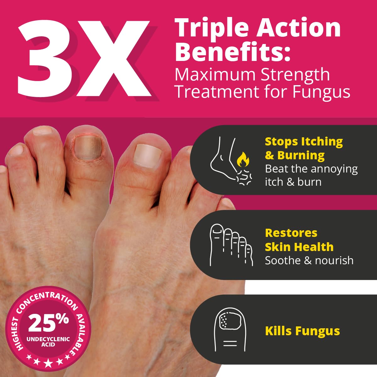 Better Nail - Treatment for Fungus Under & Around the Nail - Maximum Strength, 25% Anti Fungal Solution for Nail Support, Nail Restoring - Image 2