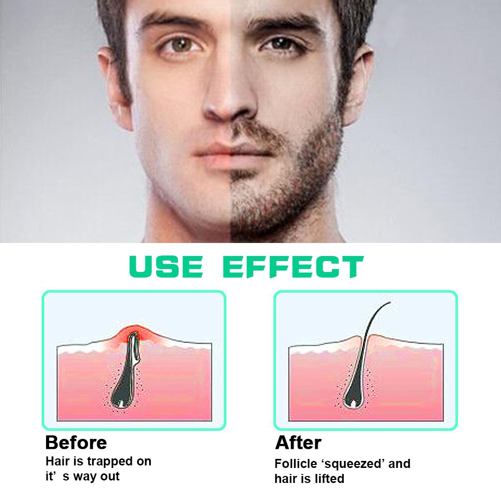 Exfoliating Brush Fine Bristle Brush For Treating Ingrown Hairs