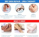 TIS farmaceutic Urea 15% Cream for Eczema, Psoriasis, Dry Rough Skin view 6