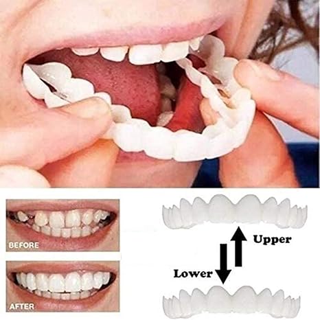 2pair Magic Smart Smile Veneers Snap On Smile Instant Perfect Smile Clip On Veneers Top And Bottom Cosmetic Teeth Veneer Perfect Smile In Minutes Amazon Ca Home Kitchen