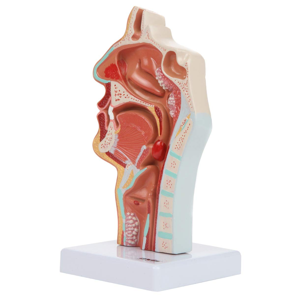 Axis Scientific Human Larynx and Pharynx Disorders Model | Shows Normal Larynx and Pharynx Anatomy and Details Common Abnormalities | Comes on White Base