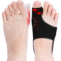 Séparateur D'Orteils En Silicone LOREY - Protection Contre Les Oignons De Pied (Hallux Valgus)