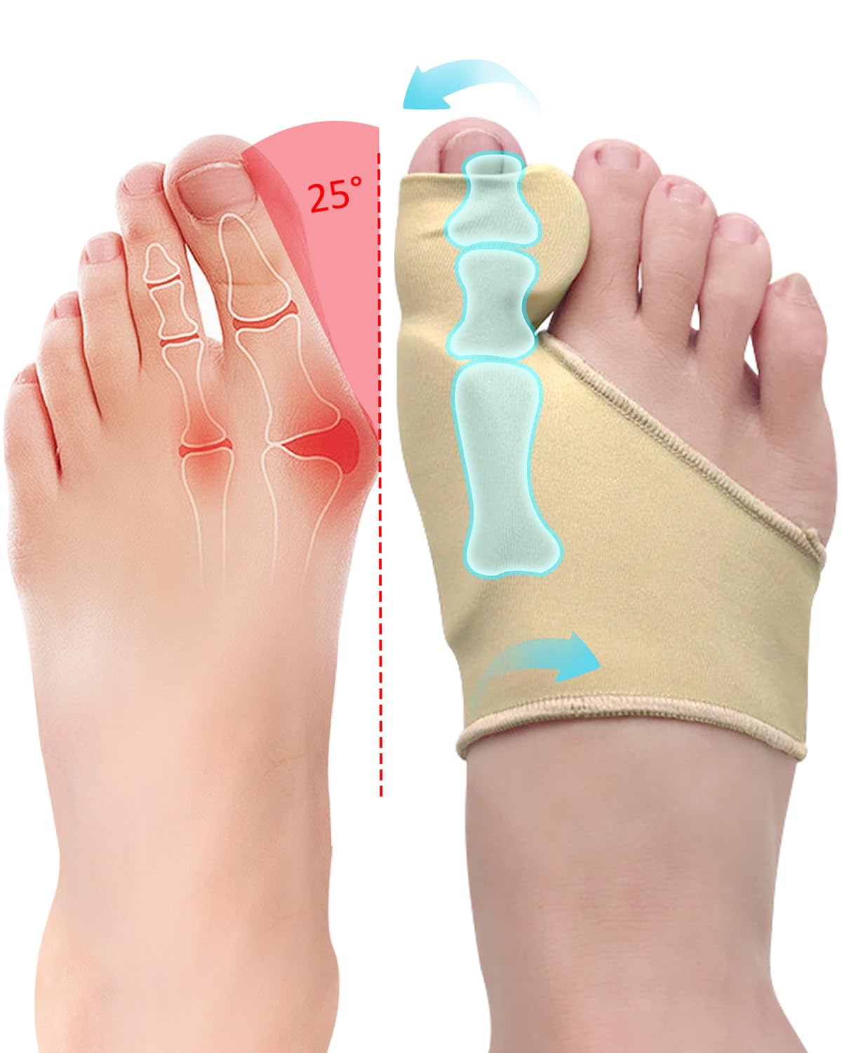 PGRODE 2 Pcs Bunion Corrector for Women Men Bunion Pain Relief, Big Toe Straighteners, Breathable Bunion Correction Socks with Built-in Gel Pad, Big Toe Spacer Separators (Beige)