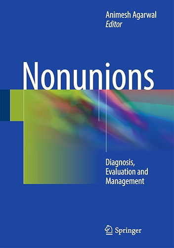 Download Nonunions: Diagnosis, Evaluation and Management (English Edition) PDF