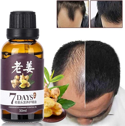 Nannday Hair Growth Liquid Fast Hair Growth Anti Loss Nourishing