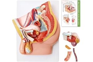 HADWYN Male Pelvis Reproductive Anatomy Model,Life Size 5-Parts Pelvis Model on Baseboard, Muscular,Urinary,Reproductive System,Anatomy Medical Model for Science Education with Detailed Product Manual