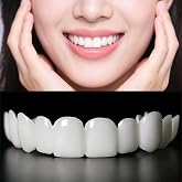 2 Pairs Adjustable Cosmetic, Realistic Lifelike Fit for Men &amp; Women, Comfortable Upper &amp; Lower Smile Covers (White)