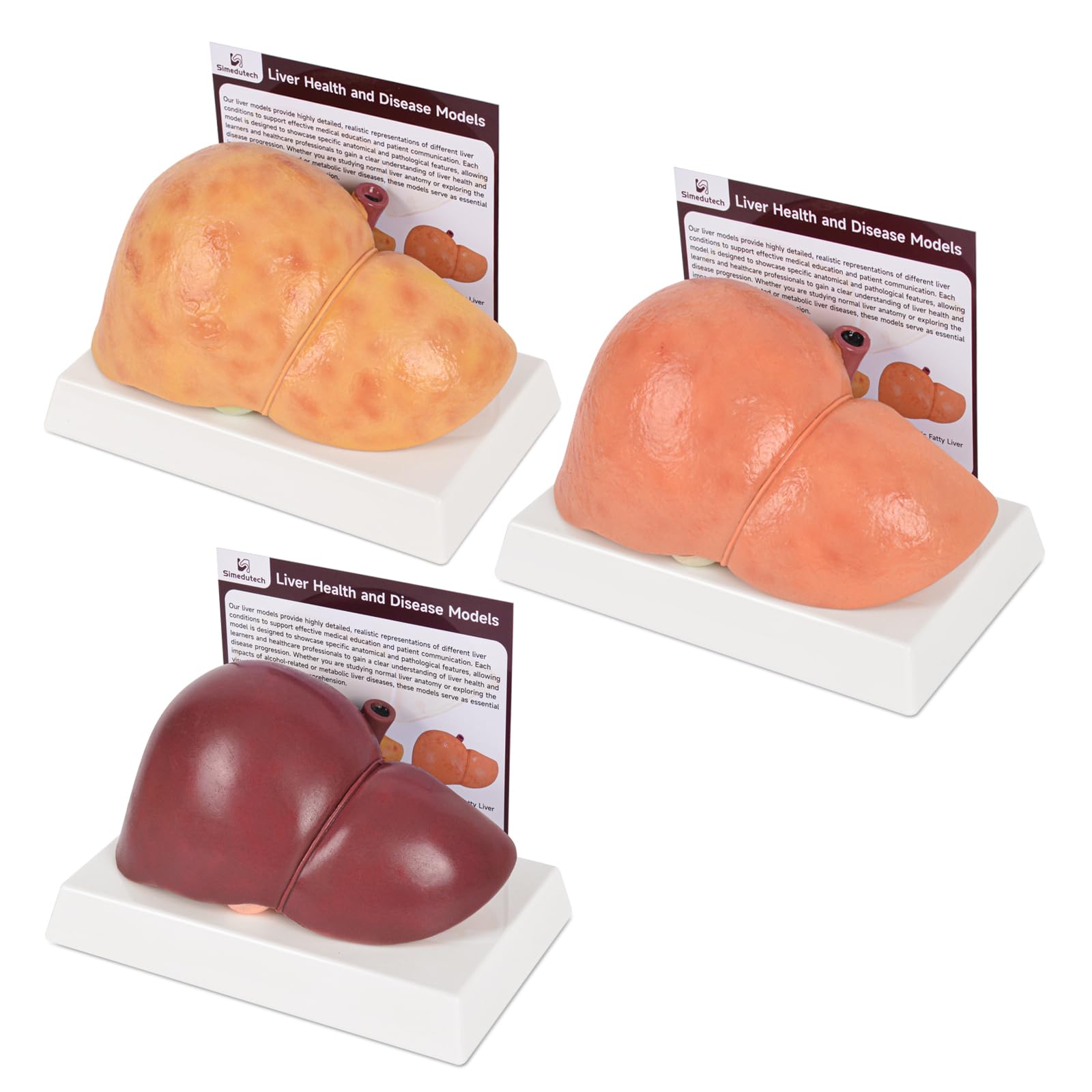 Photo 1 of Simedutech Silicone Comparative Liver Model, Life-Size Human Liver Anatomy Model for Medical Teaching, Nursing Training & Health Education