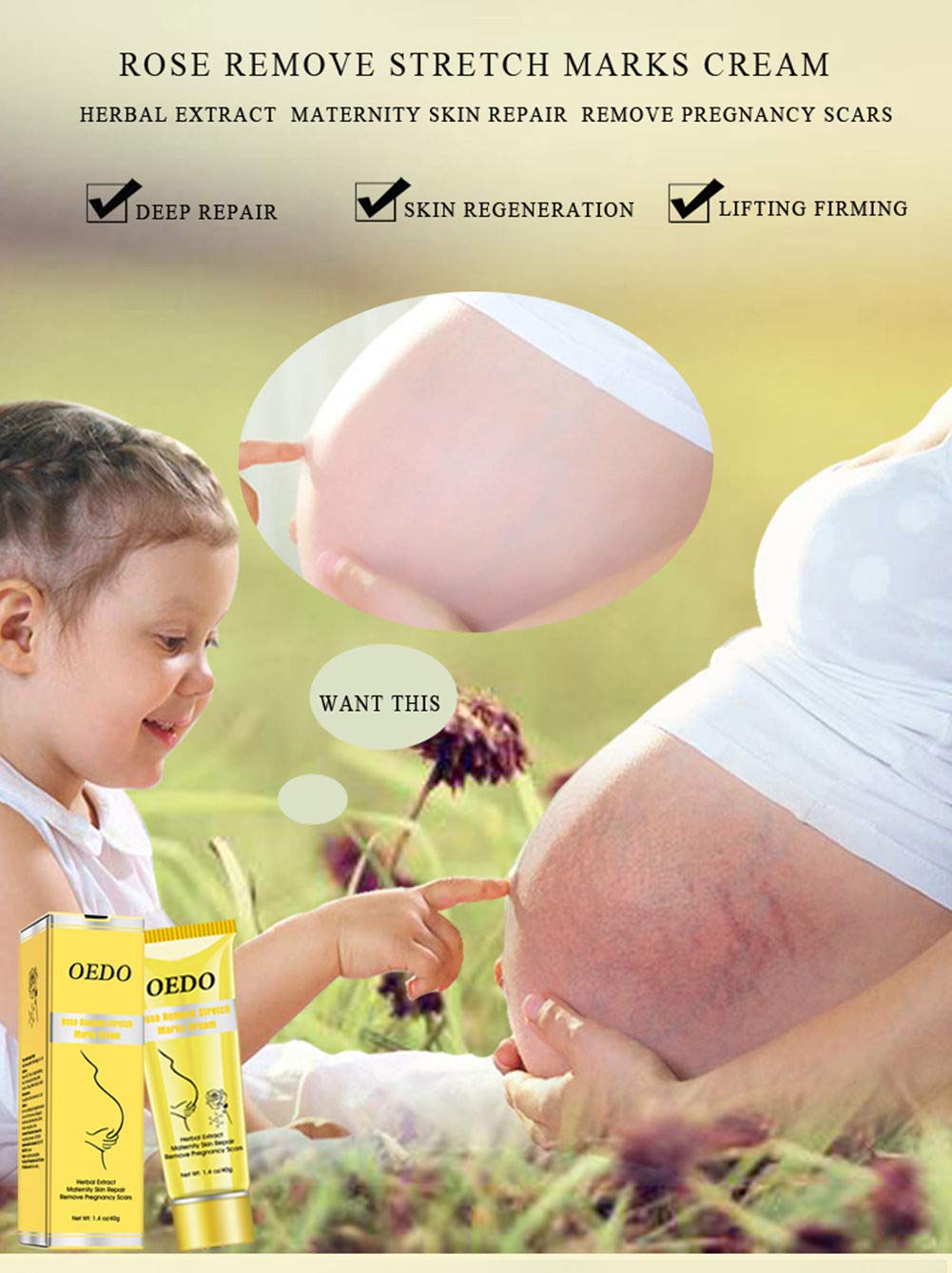 rose remove stretch marks cream