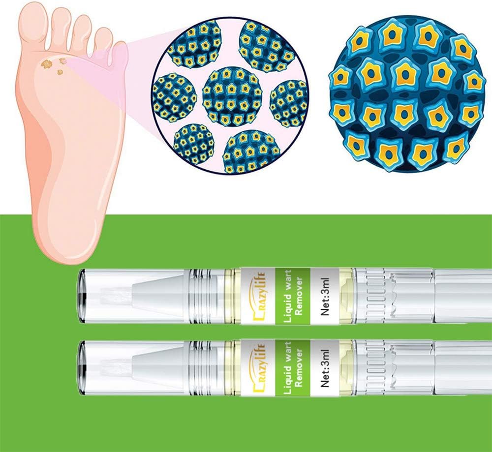Skin Tag Remover Wart Remover for Neck Quickly Tag Mole Remover for Common and Plantar Warts,2pcs: Health & Personal Care