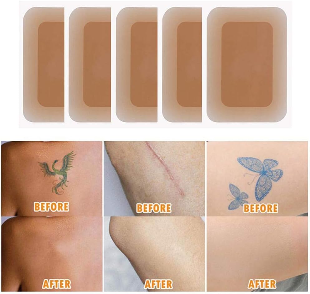 Breathable Tattoo & Flaw Concealing Tape Tattoo Covers and Skin Shields Cover Up Tape Free To Cut Smudge And Waterproof Any Part, Flesh-Colored(5pcs)
