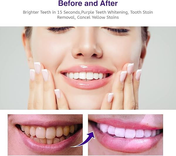 PURPLE TOOTHPASTE FOR TEETH WHITENING: TOOTH STAIN REMOVAL AND BOOSTER, TOOTH FOAM, TOOTHPASTE