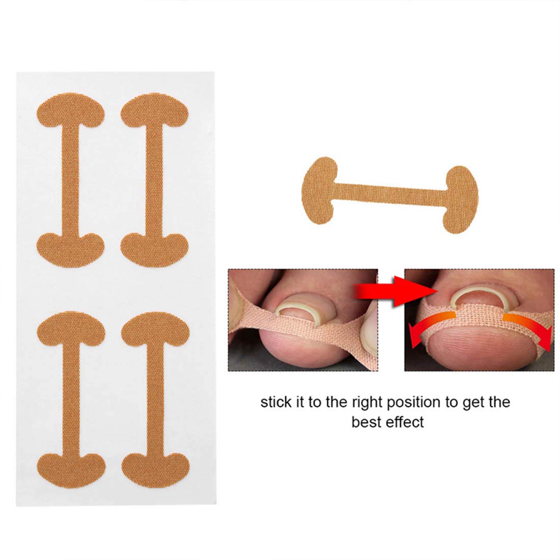 20 Pcs Ingrown Toenail Corrector Stickers, Toe Nail Treatment Elastic Patch Sticker Corrector Pedicure Tools Fingernail Toe Nail Care Protects Toe Nail: Beauty
