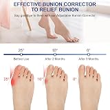 ACWOO Bunion Corrector Set for Women and Men with 2 Splints & 2 Toe view 3