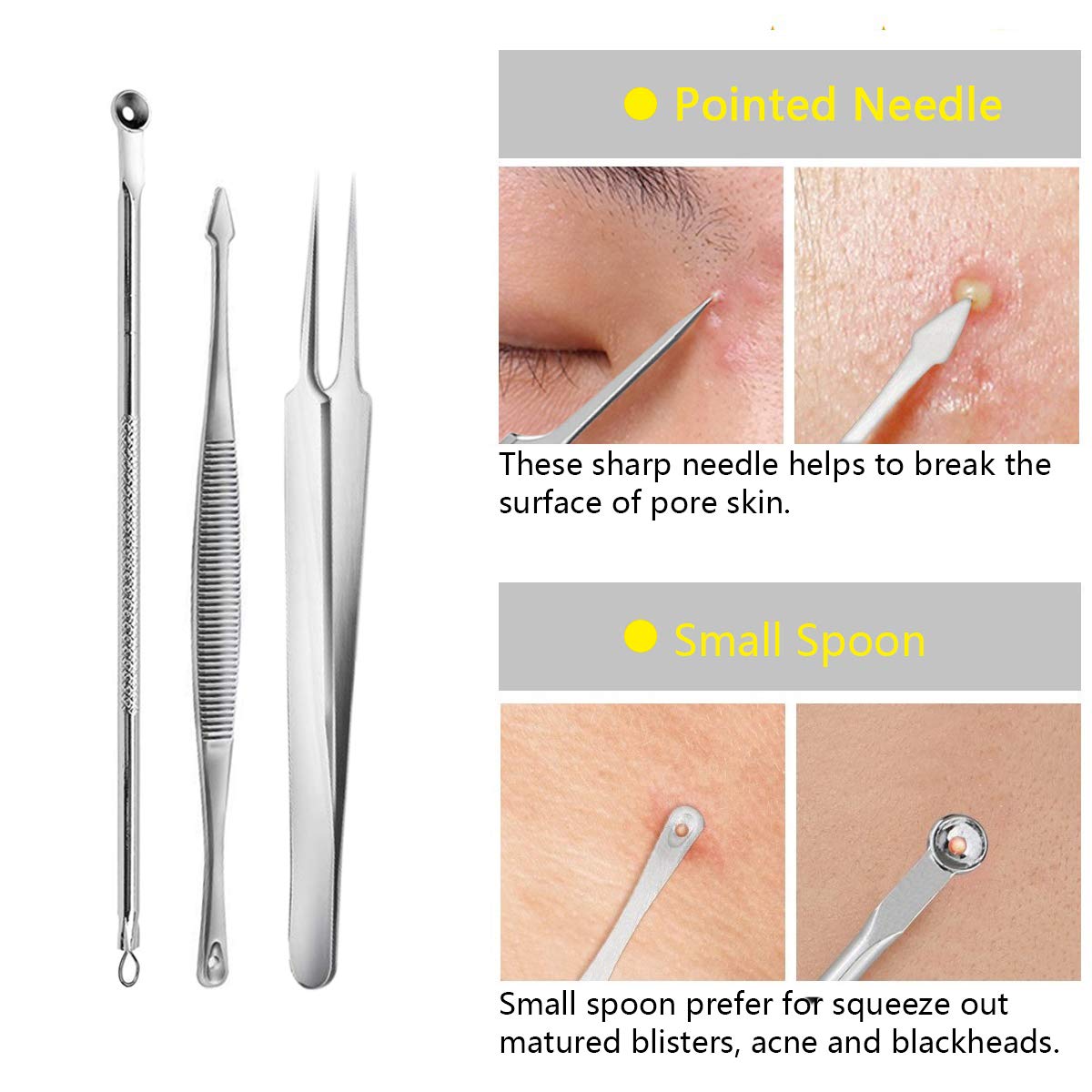 Blackhead Remover Acne Tool 9PCS Kit, Aooeou Professional Stainless Steel Curved Pimple Tweezers Comedone Extractor Instrument Tool Set for Curing Facial Blemish Whitehead: Beauty