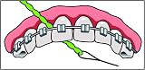 iDontix IDontix Brace X-Floss Green Dental Floss Tool view 7