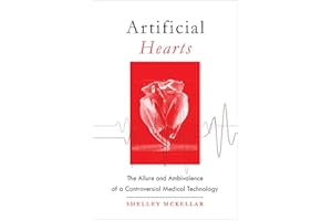 Artificial Hearts: The Allure and Ambivalence of a Controversial Medical Technology