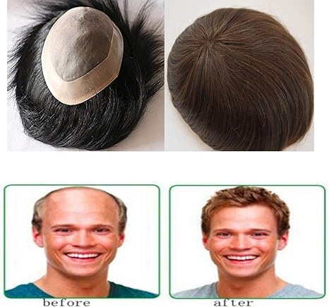 Morges Human Hair Patch For Mens Natural Hair Wig High Quality