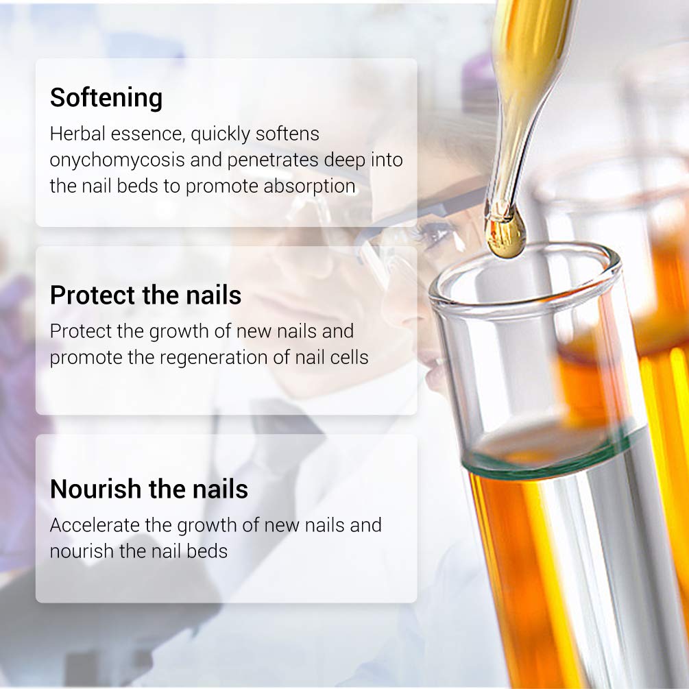 Fanmin Toenail and Nail Repair Essence, Remove Paronychia Onychomycosis Toe, Toenail and Nail Care Solution, Toenail and Nail Renewal, Fixes and Restores Discolored and Damaged Nails : Beauty