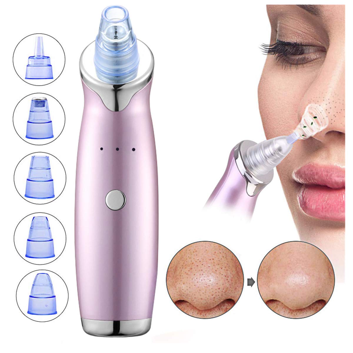 Blackhead Remover Vacuum, Electric Facial Pore Cleaner Acne Comedone Extractor Set with 5 Suction Probes and 3 Adjustable Suction Force for All Skins -USB Rechargeable