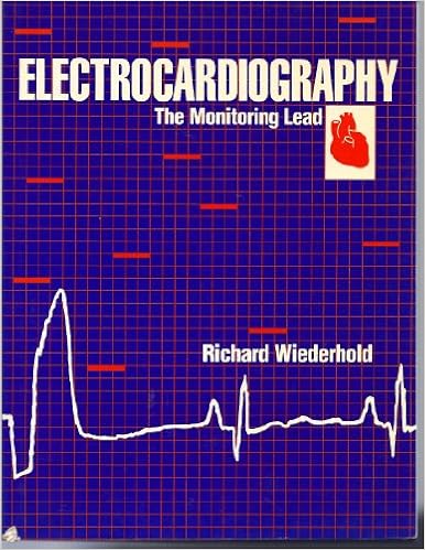 Electrocardiography: The Monitoring Lead