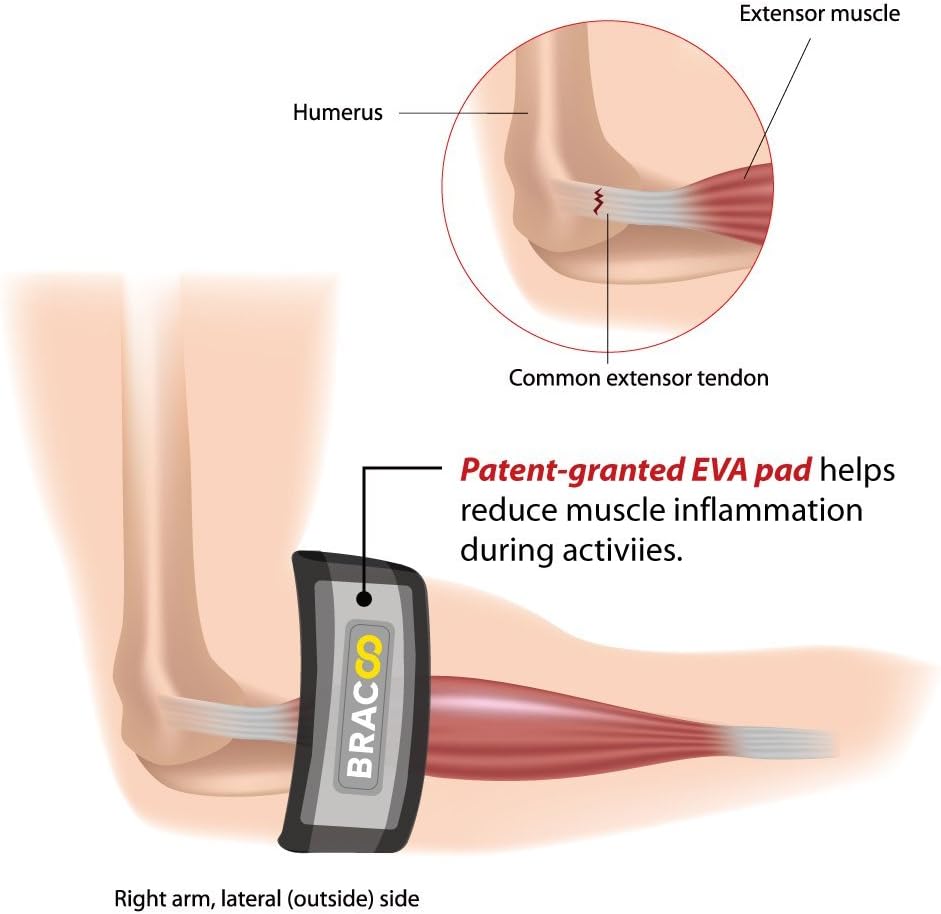 Bracoo Tennis-Golfer Elbow Strap, Quality Compression EVA Pad for Tendonitis, Muscle Strain Relief, EP40, One Size,Gray: Sports & Outdoors
