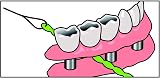 iDontix IDontix Brace X-Floss Green Dental Floss Tool view 3