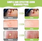 ACWOO Corn Remover Pads 48Pcs Foot Corn Wart Cushions with Hole view 4