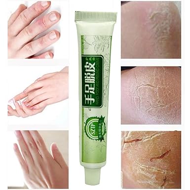 Orcbee Cracked Heel Balm Cream For Rough #virtue #after #shave #balm Orcbee Cracked Heel Balm Cream For Rough