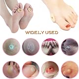 nasuniaoda Corn Cushions 90pc Latex Foam Self Adhesive Callus Pads Pain Relief view 7