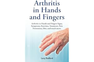 Arthritis in hands and fingers. Arthritis in Hands and Fingers Signs, Symptoms, Exercises, Treatment, Pain Prevention, Diet a