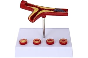 BESTYASH Cardiovascular Model 7.08X6.29X5.11In Blood Vessel Anatomy Teaching Model for Human Heart and Vascular Education