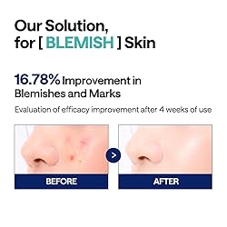MEDIHEAL Madecassoside Toner Pads - with Centella