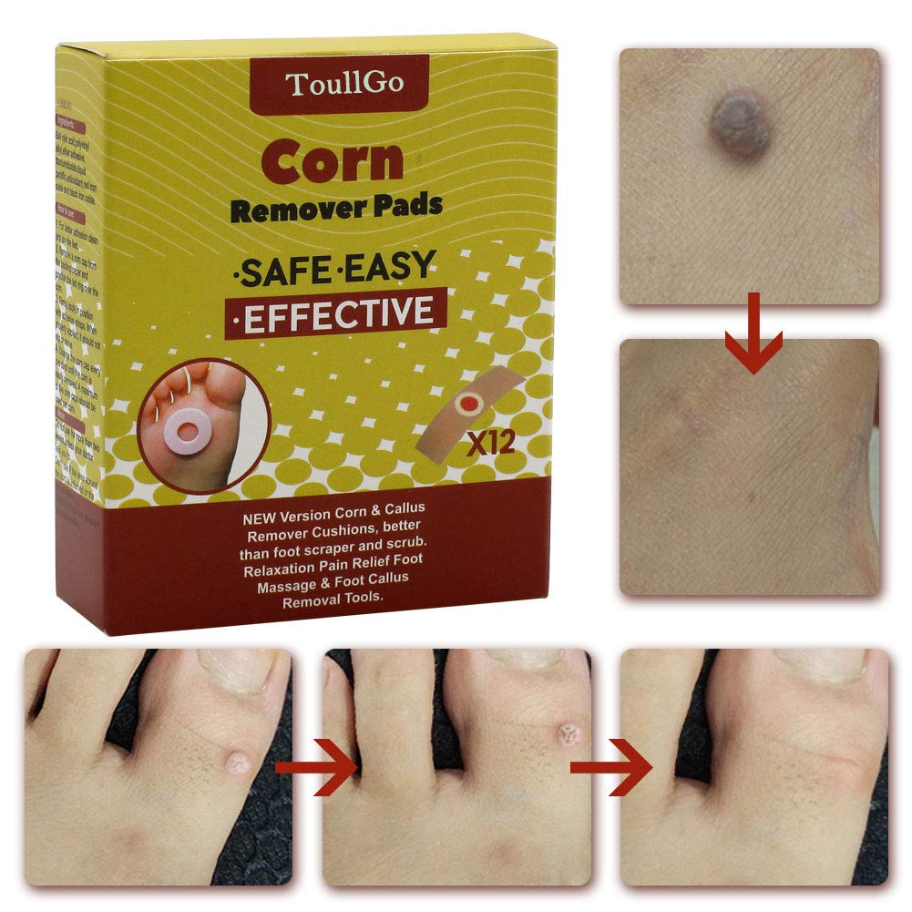 Corn Remover Pads, Corn Removal, Corn Remover, Corn Wart Remover, Corn Callus Remover, It is a Better Solution for People Who Suffer The Pain of Corn, 12Pcs/Box : Beauty
