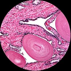 AmScope MU130 1.3MP USB2 Microscope Digital Camera