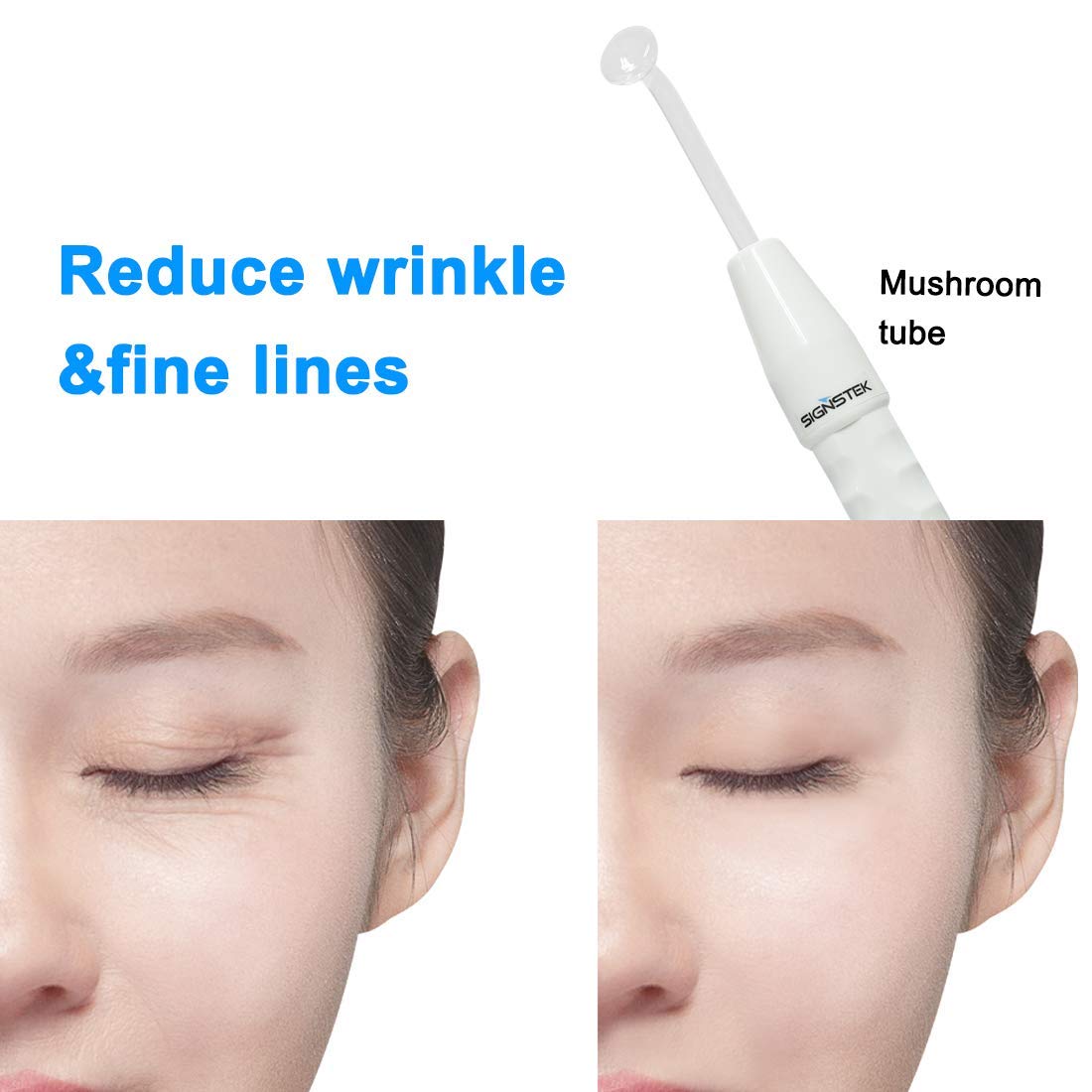 Signstek Portable High Frequency Face Wand Facial Machine for Skin Tightening, Acne Wrinkles Remover, Puffy Eyes: Beauty