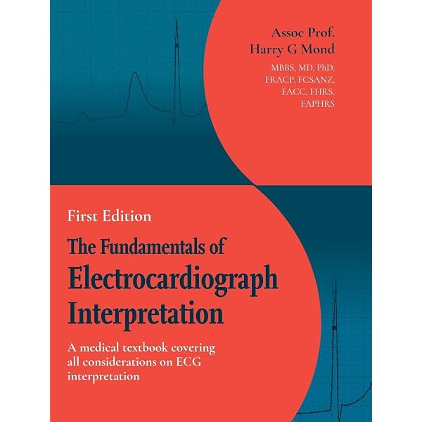 The Fundamentals of Electrocardiograph Interpretation: A medical
