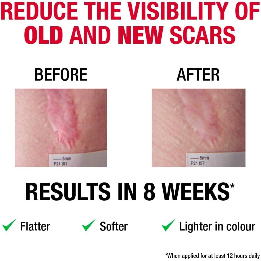 Elastoplast XL Scar Reducer Plasters (21 Pieces), Extra Large Scar Cover Up Treatment, Scar Sheets to Reduce Visbility of Scars, Scar Plaster Pack for Quick Results - Image 4