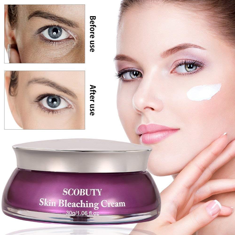 best whitening cream for freckles