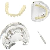 Dental Overdenture Inferior Model 4 Implants Upper Jaw Removable Demo Model | For Dentist Education and Study