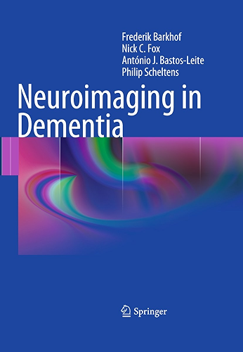 Download Neuroimaging in Dementia (English Edition) PDF