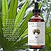 Laritelle Organic Loss Prevention for Men/Women, Prevents Shedding, Promotes New Healthy Hair Growth and Scalp Health, Rosemary/Lemongrass/Ginger/Cedarwood, 4 oz.