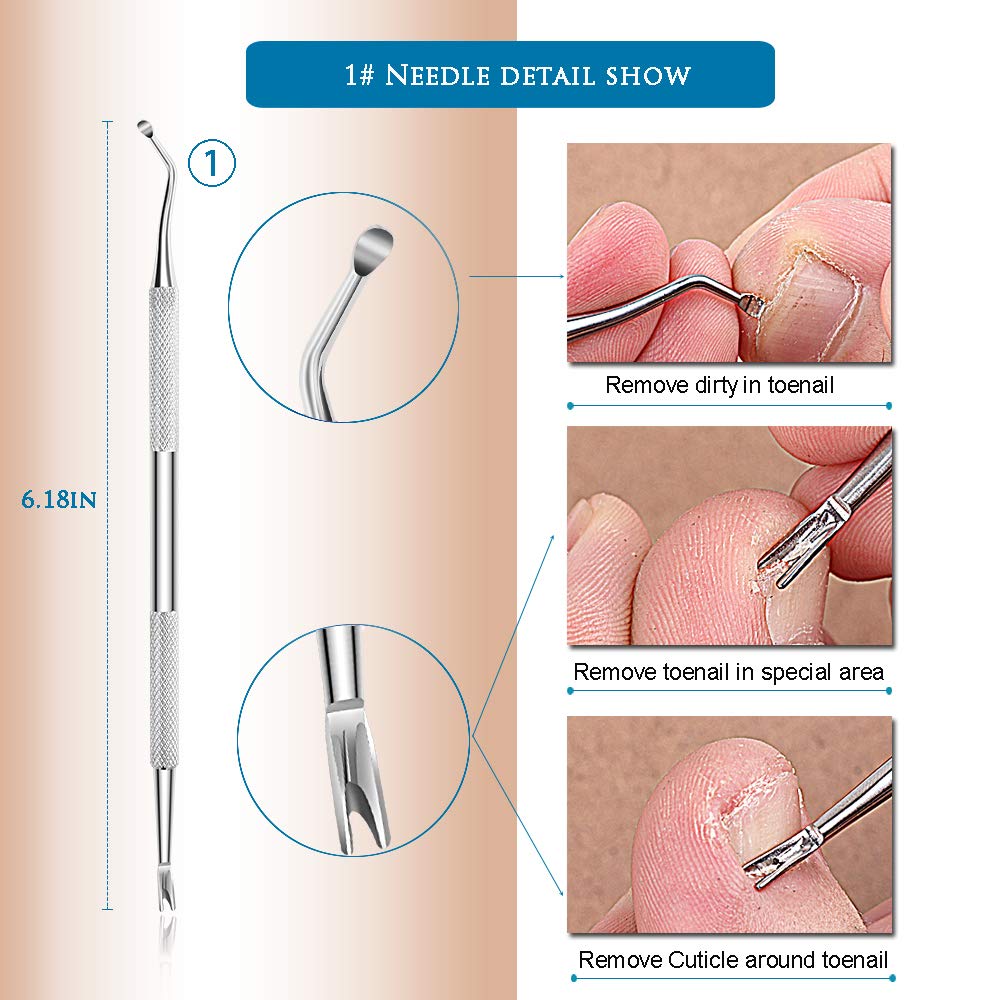 Premium 6PCS Ingrown Toenail Tools, Nail File and Lifter, Foot Nail Treatment Tool, Toe Nail Removal Clippers, Upgraded Stainless Steel, Professional Pedicure Tools, With Nail Cutter Trimmer: Beauty